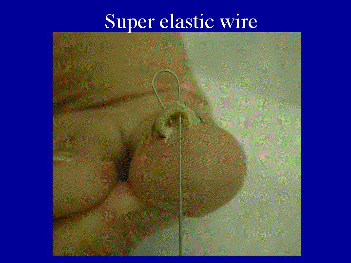 Slide 4 (se-wire) 