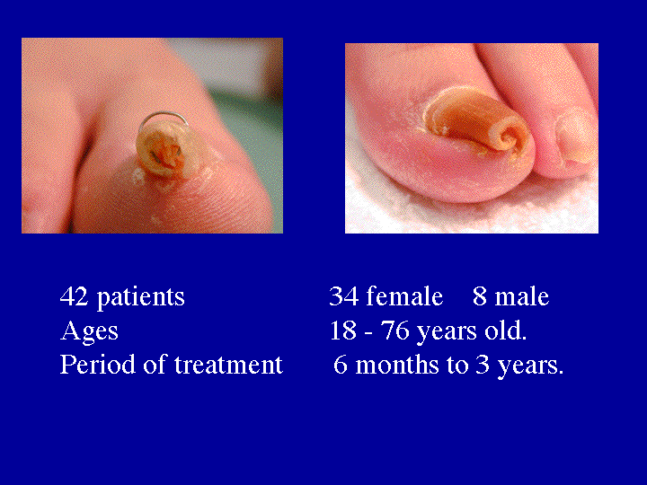 Slide 6 (patients) 