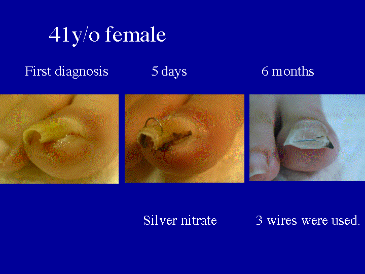 Slide 10 (41y/o patient) 